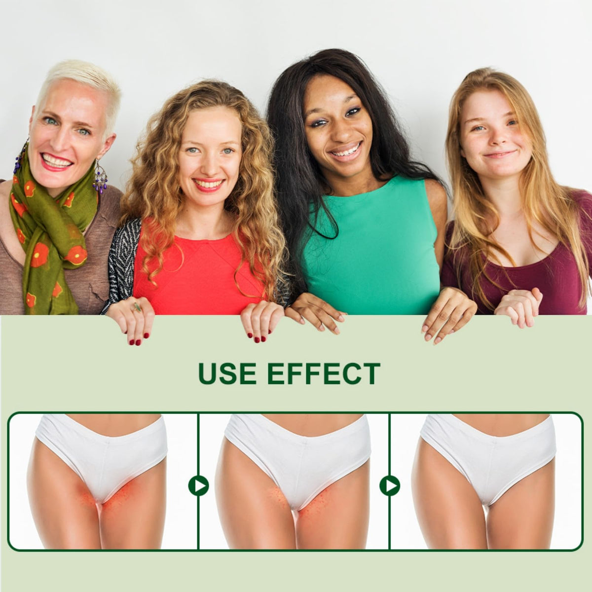 ChengJin 2Pcs Anti Fungal Skin Cream,Deodorizing Anti-Fungal Cream,Tea Tree Cream for Woman,Itchy Skin Relief for Man&Woman,Prur/itus Cream for Private Parts,Anti Itching Cream,External Cream for Men and Women