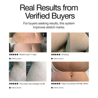 Stria Lab Stretch Mark Prevention Oil for Pregnancy & Scars | Skin Care, Stretch Marks & Scar Prevention Treatment | Hydrating, Fast-Absorbing Serum for Women