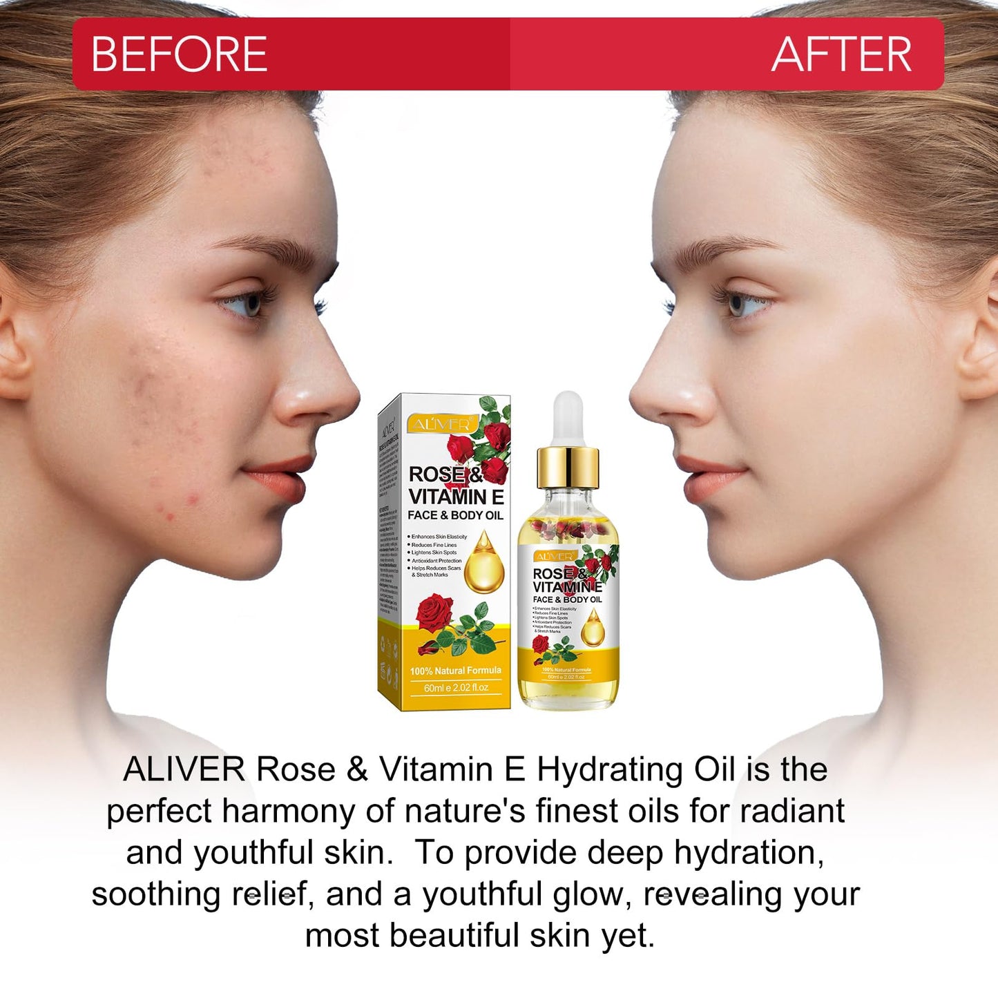 RoongDuuDll Vitamin E Oil for Face with Rose Essential Oil, Gua Sha Facial Oil, Vitamin E Face Oil for Anti-aging, Scars & Stretch Mark, Natural Massage Body Oil Scented for Dry Skin, Scalp and Nail - 60ml