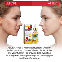 RoongDuuDll Vitamin E Oil for Face with Rose Essential Oil, Gua Sha Facial Oil, Vitamin E Face Oil for Anti-aging, Scars & Stretch Mark, Natural Massage Body Oil Scented for Dry Skin, Scalp and Nail - 60ml