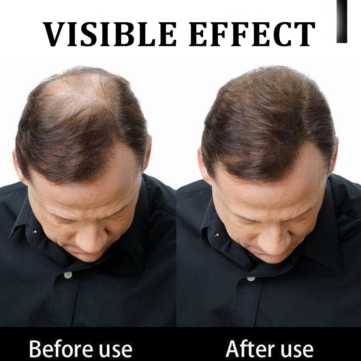 DMQ Hair Building Fibers,Natural Hair Fibers for Men & Women,Hair Fibres Dark Brown,Hair Powder for Thinning Hair,Easily Cover & Waterproof,Hair Loss Concealer,Instantly Conceals Hair Loss,Soft Powder