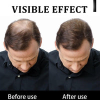 DMQ Hair Building Fibers,Natural Hair Fibers for Men & Women,Hair Fibres Dark Brown,Hair Powder for Thinning Hair,Easily Cover & Waterproof,Hair Loss Concealer,Instantly Conceals Hair Loss,Soft Powder