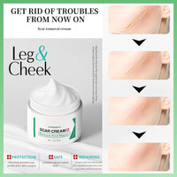 Scar Removal Cream for Face & Body - Treatment for New Scars, Stretch Marks, Acne Spots & C-Sections Treatment Cream, 50g, Natural Formula for Face and Body, Reduces Old and New Scars