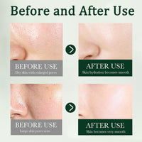 ISBEAUSOLS Tea Tree Acne Cream 50g - Spot Cream for Acne & Pimple - Dark Spot Remover for Face - Blackhead Remover Cream - Skin Care Face Cream for Women - Oil Control, Soothing and Moisturizing Pimple Cream