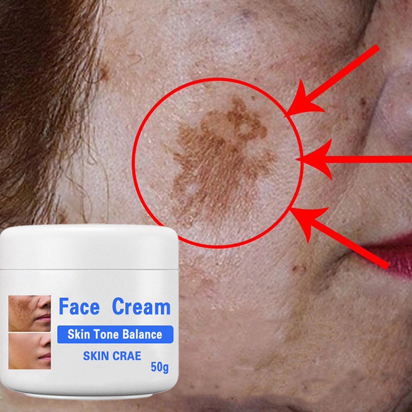 GNAUMORE Dark Spot Corrector Cream,Sun Spots and Melasma Freckle Remover,Spot Remover For Face Serum,Moisturizing Removes Facial Melasma Dark Spots Wrinkles Blemishes 50G