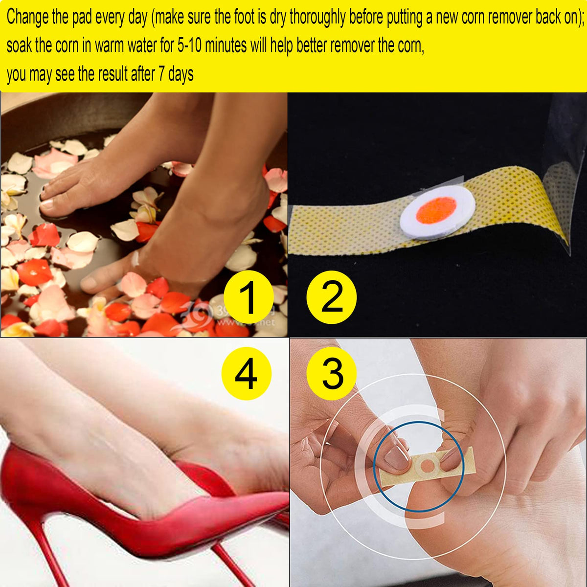 Mcvcoyh Corn Removal 35 Pieces Corn Remover Pads Wart Remover Callus Cushions Treatment Relief Corn Pain and Foot Care