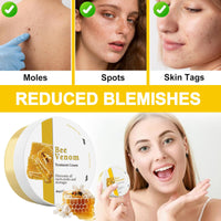 Trendyfave Bee Venom Cream, Bee Venom Skin Treatment Cream, Skin Repair, Enriched with Bee Venom & Natural Extracts, Body Moisturiser, Revitalises Skin, Suitable for All Skin Types, 2Pcs