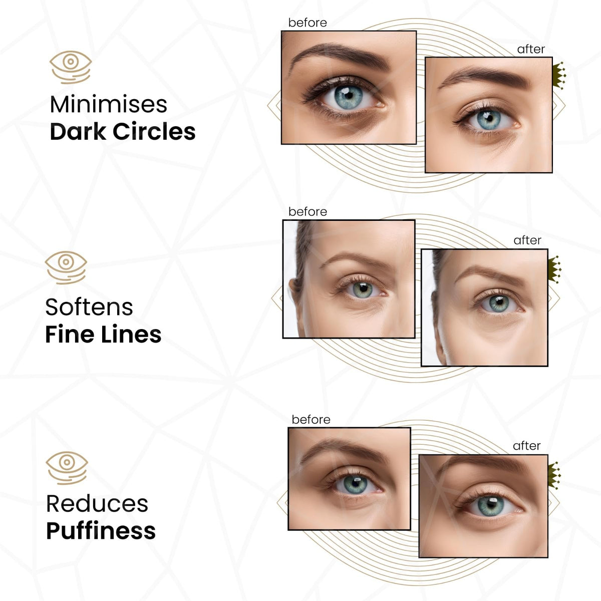 Tomsey 10 Pair Eye Masks & 10 Lip Masks Crystal Collagen 24k Gold Under Eye Gel Pad Face Mask Anti Aging Wrinkle Gel Lip Plumping Patches, Vegan Cruelty-Free Self Care Beauty