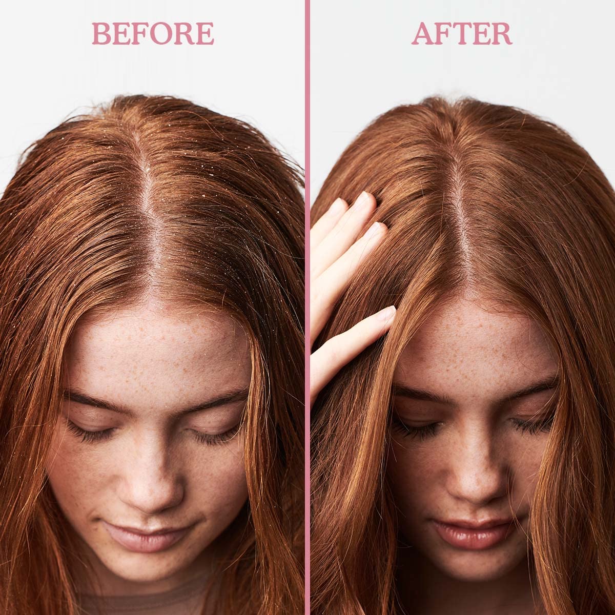 Umberto Giannini Scalp Scrub, Vegan & Cruelty Free Exfoliating Anti-Dandruff Scalp Rescue Scrub