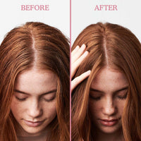 Umberto Giannini Scalp Scrub, Vegan & Cruelty Free Exfoliating Anti-Dandruff Scalp Rescue Scrub