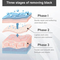 Skin Lightening Cream For Dark Skin,Acanthosis Nigricans Cream,Dark Armpit Treatment,Dark Underarms Treatment,Lightening Cream,Underarm Bright Skin Cream,Mild