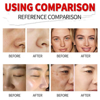 Kojic Acid Face Cream and Kojic Acid Face Serum - Skin Lightening Cream for Anti Aging - Dark Spot Remover for F-ace - Hydrating Serum for Dry Skin - Even Skin Tone, Anti Wrinkle, Moisturising