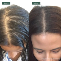 Regrowz Hair Growth Oil 120ml – Rosemary, Argan & Jojoba Oils for Hair Growth & Scalp Care | Natural Hair Serum for Men & Women | Moisturises Dry, Damaged Hair – UK Hair Loss Treatment
