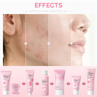 Skin Care Sets & Kits - Skincare for Teenage Girls Gift Set - Face Care For Pores,Exfoliate,Sakura Travel Kit - Mask,Peel Mask,Toner,Gel,Cleanser,Cream,Facial Cleansing Brush,Bag（8pcs）