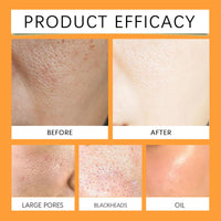 Turmeric Kojic Acid Pads - 30 Pads Kojic Acid and Turmeric Pads - Turmeric Face Pads for Dark Spot - Exfoliating Cleansing Pads for Face & Body - Turmeric Pads for Even Skin Tone, Pore Cleansing