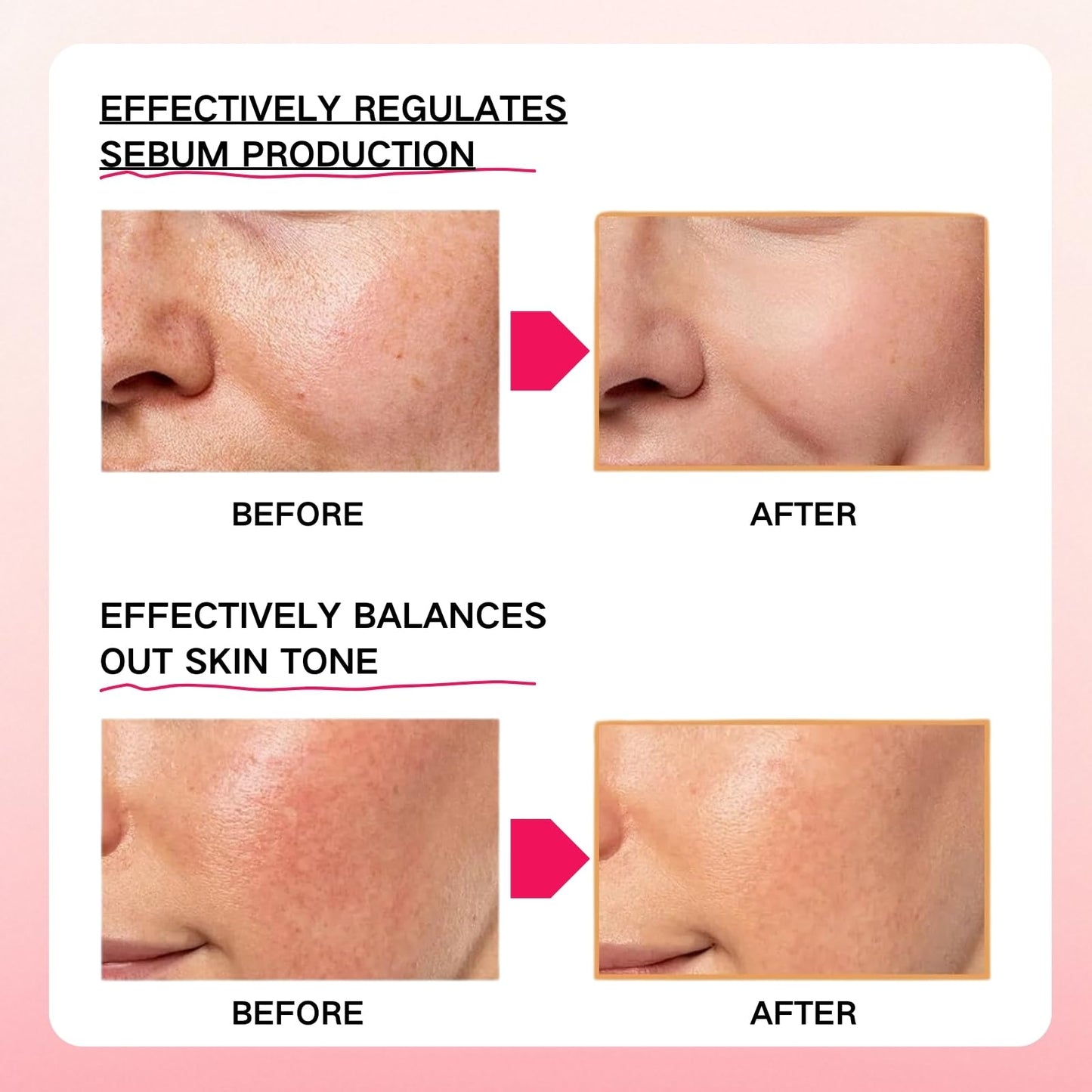 Shefave Pink Spicule Serum for Face with Niacinamide & Vitamin B12, Picotonic Glowing Serum, Anti Wrinkle Ser-um for Glass Skin, Minimizes Pores, Dark Spot, Brightening Hydrating Face Essence,Korean Skin Care