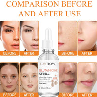 Glutathione Serum with Kojic Acid & Vitamin C - Nicotinamide Serum for Face for Hydrated - Face Serum Reduce Dark Spot Shrink Pores& Improve Skin Tone,(1pcs)