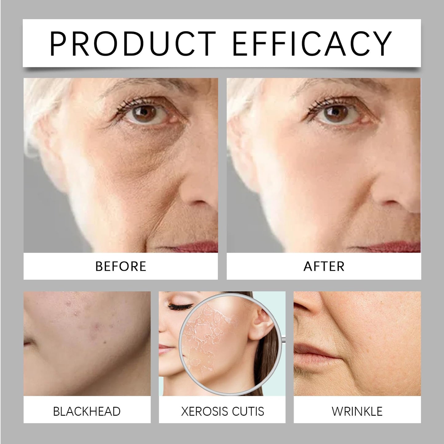 GNAUMORE Spot Remover For Face Serum,Dark Spot Corrector Cream,Sun Spots and Melasma Freckle Remover,Spot Remover For Face Serum,Sun Spots and Melasma Treatment Cream for Face 50G