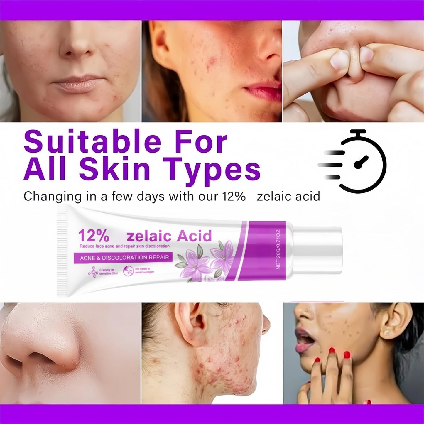 Acid 12% Facial Serum,Anti Acne Cream Face Serum,Aze/laic Aci/d for Anti Acne,A/cid Face Spot Treatment,Night Cr/eam Face Moisturiser,Skin Care Gel, A cne C/ream Skin Care,Acid Serum