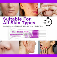 Acid 12% Facial Serum,Anti Acne Cream Face Serum,Aze/laic Aci/d for Anti Acne,A/cid Face Spot Treatment,Night Cr/eam Face Moisturiser,Skin Care Gel, A cne C/ream Skin Care,Acid Serum