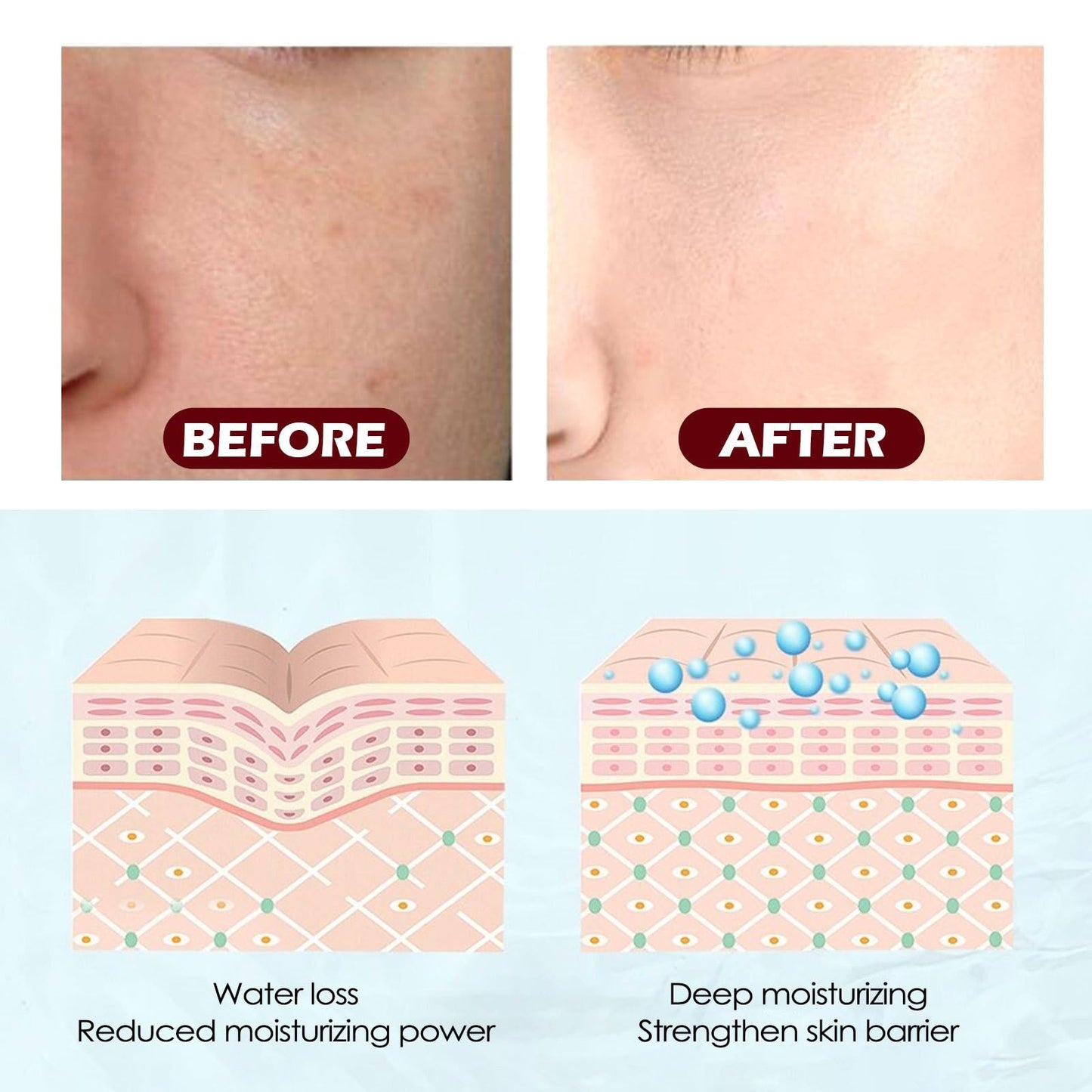 AINxtolm Acne Cream,Acne Treatment Cream,Japan Anti A/cne Treatment,Anti Ac/ne Face C/ream,Japanese Acn/e Cre/am,Face Ac/ne Treat/ment,Acn/e Treatm/ent Removal C/ream,Acne Treatme/nt Gel,Spot Treatmen/t