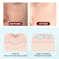 AINxtolm Acne Cream,Acne Treatment Cream,Japan Anti A/cne Treatment,Anti Ac/ne Face C/ream,Japanese Acn/e Cre/am,Face Ac/ne Treat/ment,Acn/e Treatm/ent Removal C/ream,Acne Treatme/nt Gel,Spot Treatmen/t