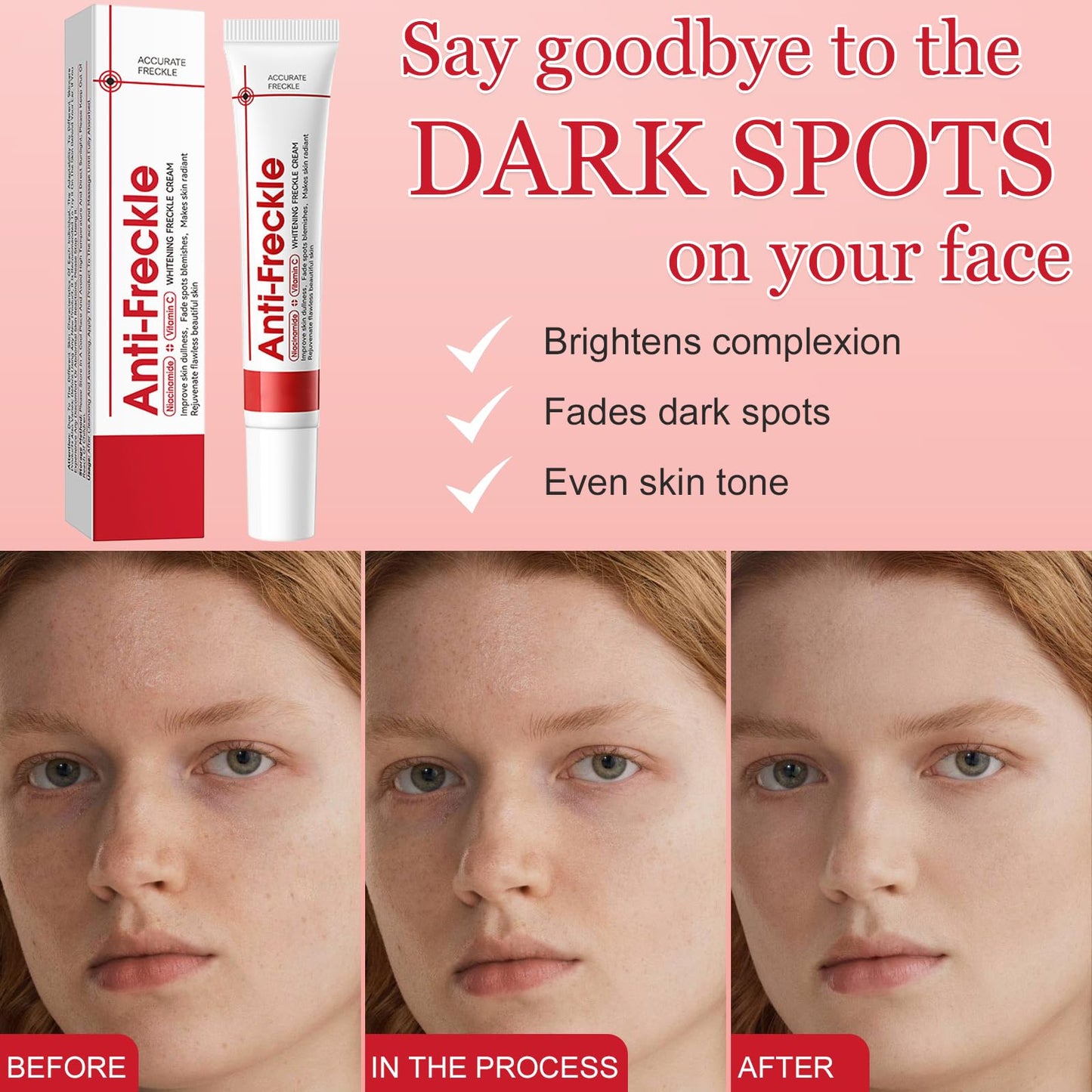 Muiefe 2Pcs Freckle Removal Cream, Dark Spot Remover for Face and Body, Dark Spot Corrector Cream with Vitamin C, E & Niacinamide, Fade Spots Blemishes, Reduces Hyperpigmentation, Improves Skin Tone