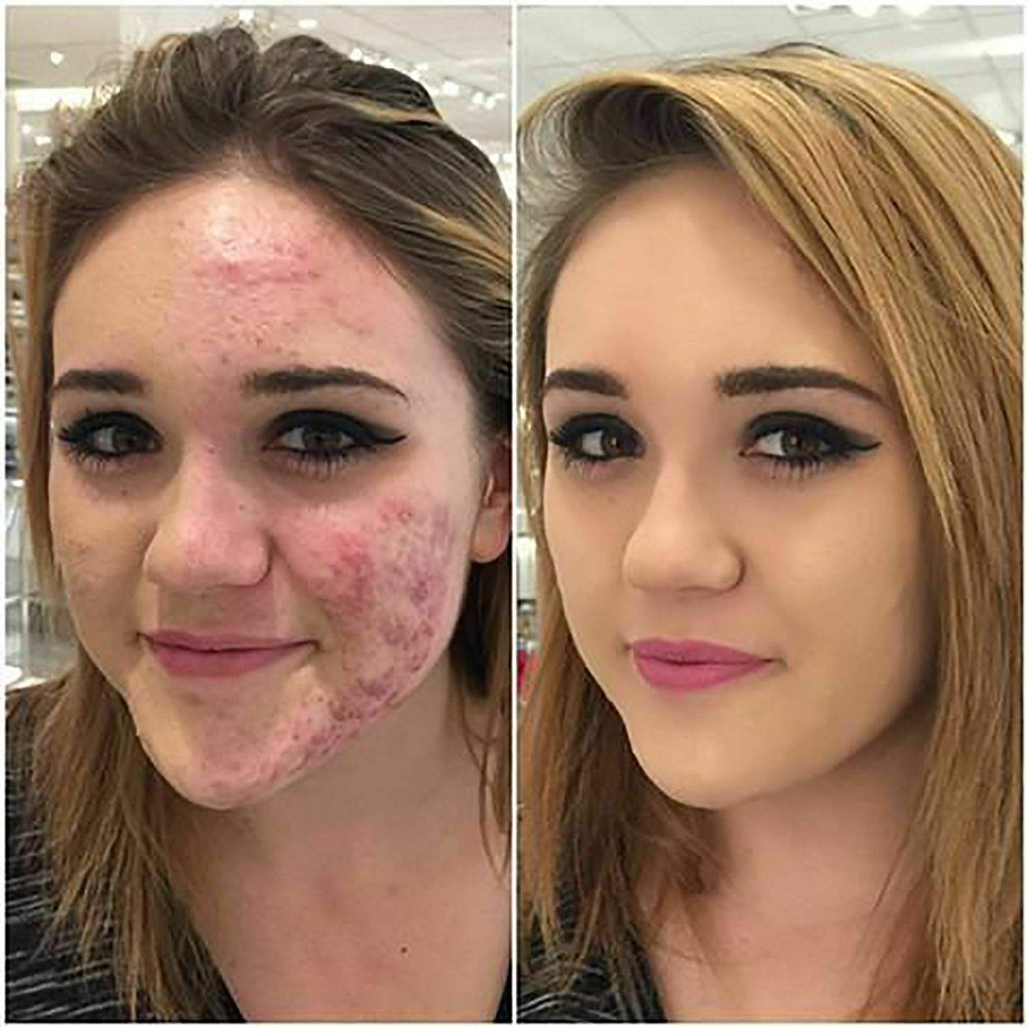 Aquapurity Phoera® Full Coverage Foundation Soft Matte Oil Control Concealer 30ml Long Lasting Flawless Cream Smooth (2PCS 104 BUFF BEIGE)