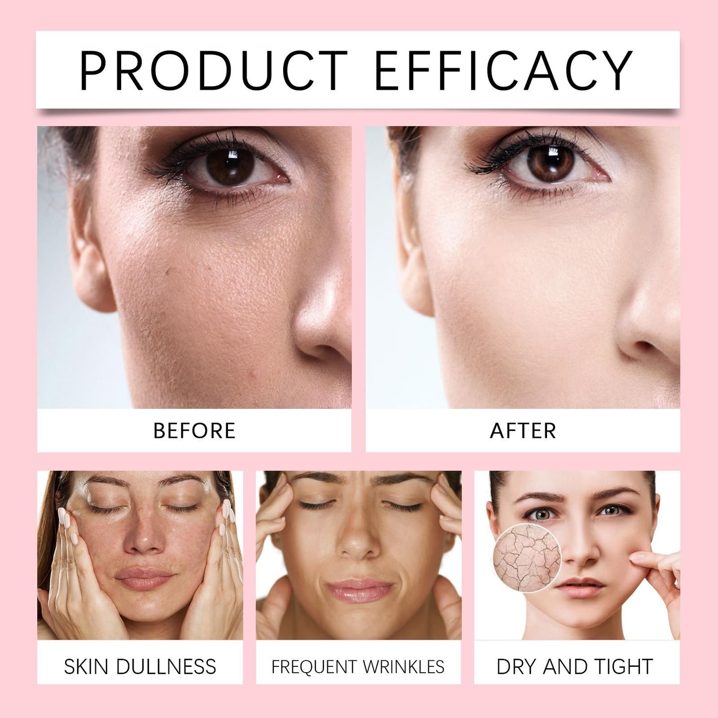 Bub~ble Skincare Slam Dunk Hydrating Moisturiser,Bubb-e Skin Caree Slam Dunk,Face Moisturising Cream for Normal to Dry Skin,Facial Moisturiser Bub~ble Skincare Sets,Level Up Balancing Moisturiser,Pink