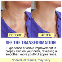 XAYGHE Neck Firming Cream | Tighten and Lift Neck Cream -Tightening & Lifting Sagging Skin - Reduce Fine Lines & Wrinkles - Advanced Neck Cream Face Moisturizing 50ML