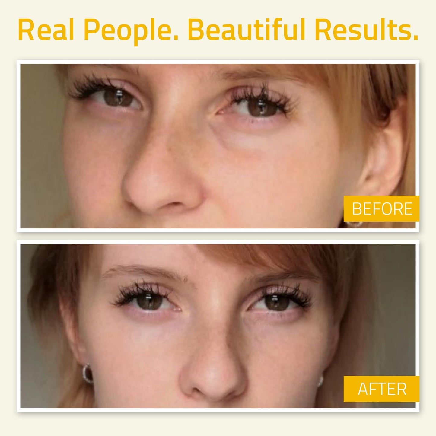 YEOUTH Eye Gel with Hyaluronic Acid, Radiance Under Eye Gel for Puffiness, Dark Circles & Eye Bags, Hydrating Eye Skin Care, Anti Aging Skin Care for Women & Men, Night Eye Gel