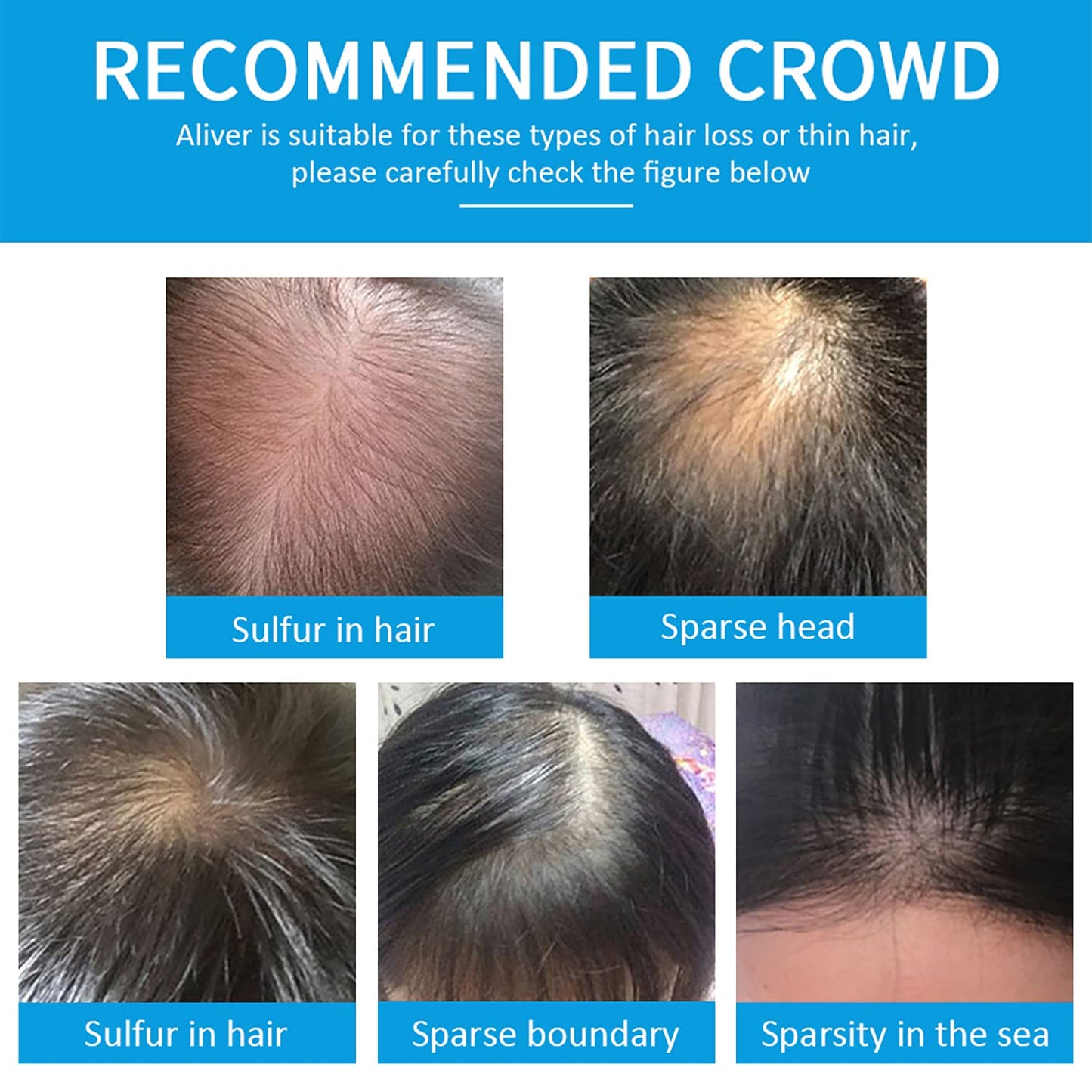 Pegciz Professional Quality Hair Fibres, Hair Fibres Black for Thinning Hair, Instantly Conceals Hair Loss in 15 Sec, Hair Loss Concealer for Women and Men (Black)
