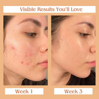 Auravedic Kumkumadi Oil, 100 Ml. Kumkumadi Face oil for Glowing Skin