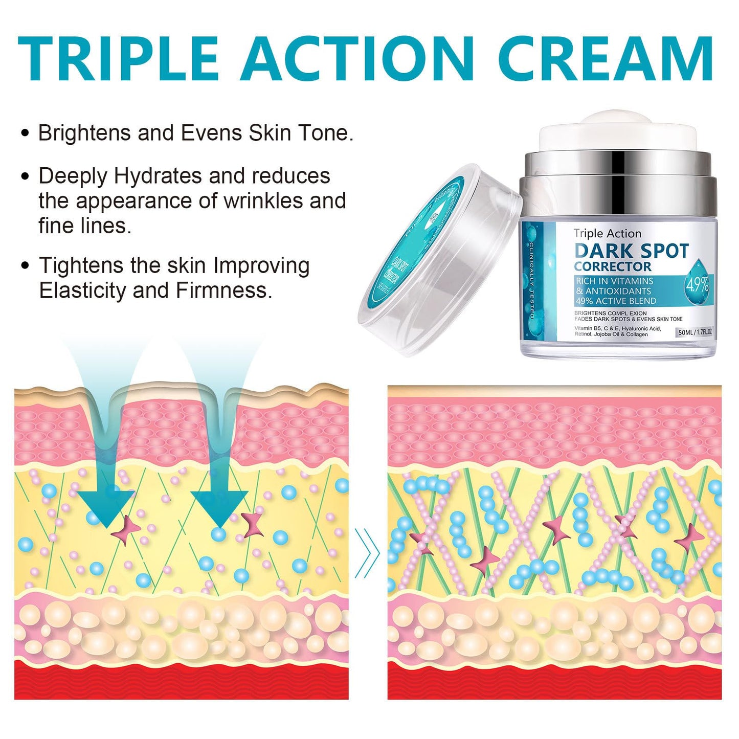 Shefave Dark Spot Remover For Face & Body, Pigmentation Removal Cream, Hyperpigmentation Treatment Melasma Cream - Reduces Dark Spots, Hyperpigmentation & Scars, Hydrates & Evens Skin Tone For Radiant Glow