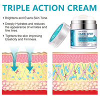 Shefave Dark Spot Remover For Face & Body, Pigmentation Removal Cream, Hyperpigmentation Treatment Melasma Cream - Reduces Dark Spots, Hyperpigmentation & Scars, Hydrates & Evens Skin Tone For Radiant Glow
