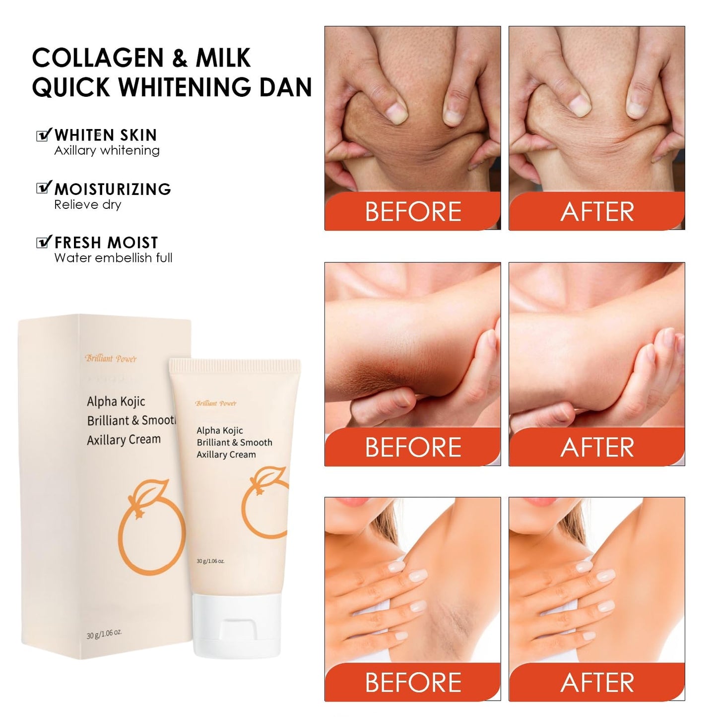 Kojic Acid Underarm Cream,Underarm Whitening Cream,Dark Underarms Treatment,Skin Whitening Body Lotion,Skin Lightening Cream,Skin Care for Armpits, Knees, Inner Thighs, Bikini Areas,Reduce Odor