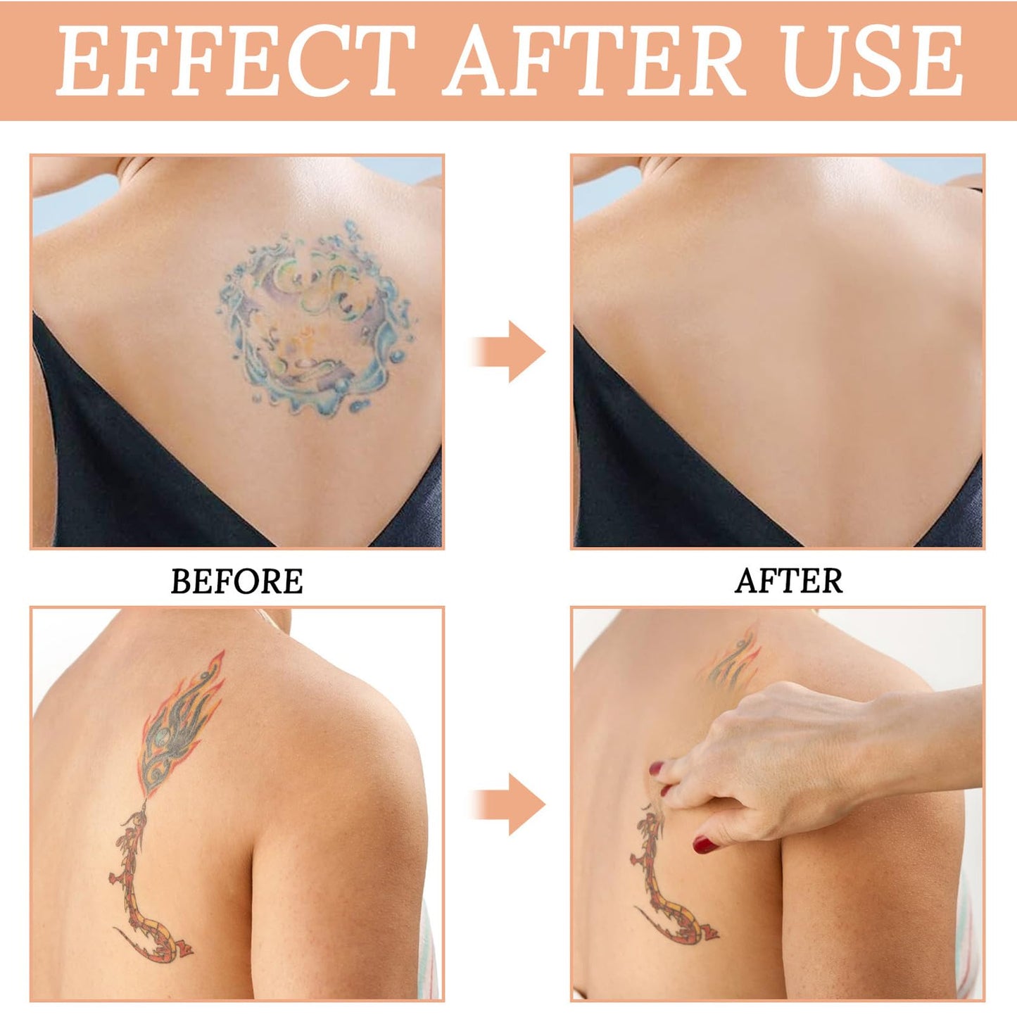 SHEBEEDO Tattoo Cover Up,Concealer Cream Full Coverage,Acne Concealer, Body Concealer, Professional Waterproof Concealer to Cover Tattoo for Men Women,Natural Tattoo Makeup Cover Body Makeup