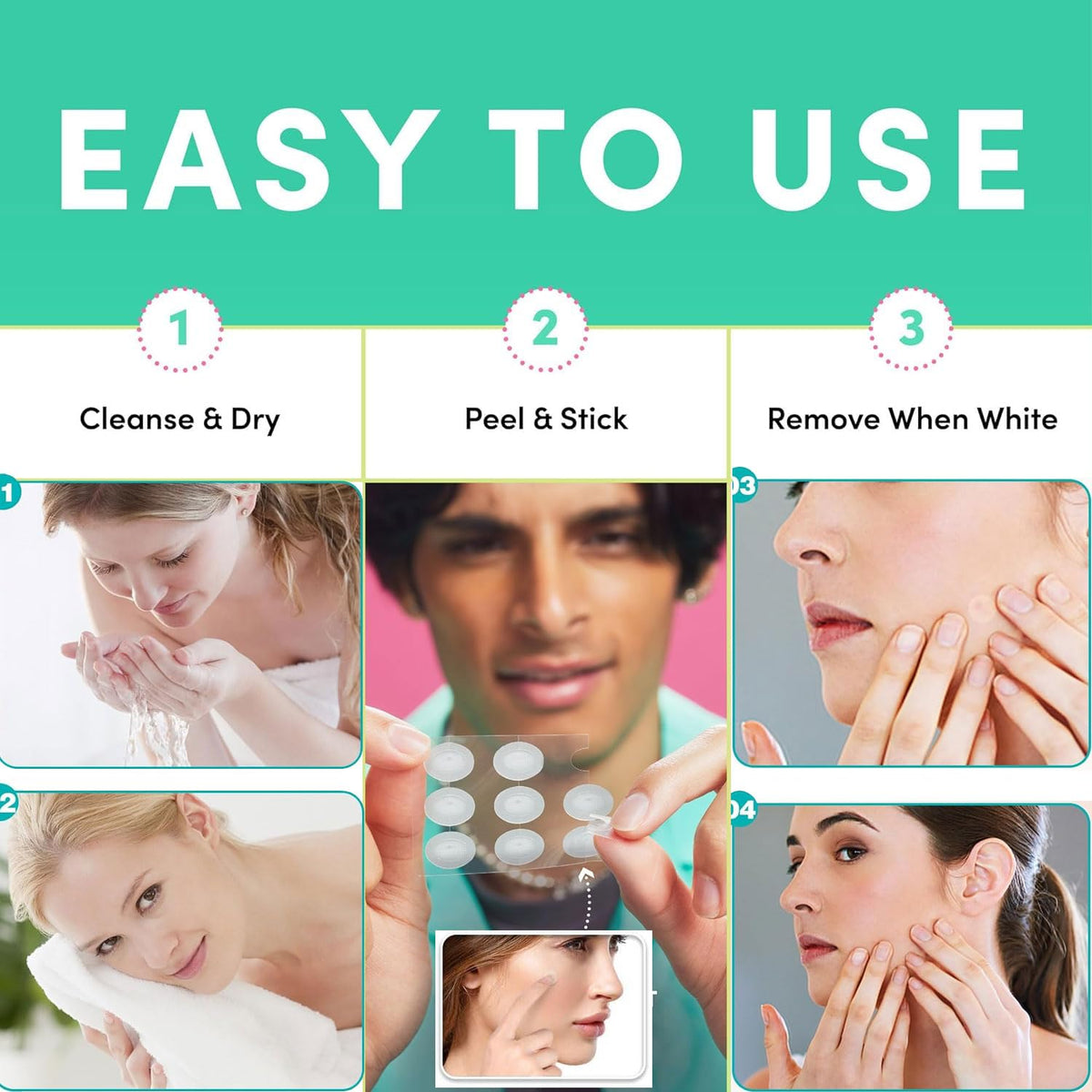 CGBOOM 360PCS Acne Pimple Master Patches,Salicylic Acid and Niacinamide, Spot & Blemish Treatment Stickers Invisible Hydrocolloid Patches, 2 Sizes （8mm, 12mm）