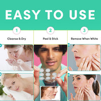 CGBOOM 360PCS Acne Pimple Master Patches,Salicylic Acid and Niacinamide, Spot & Blemish Treatment Stickers Invisible Hydrocolloid Patches, 2 Sizes （8mm, 12mm）