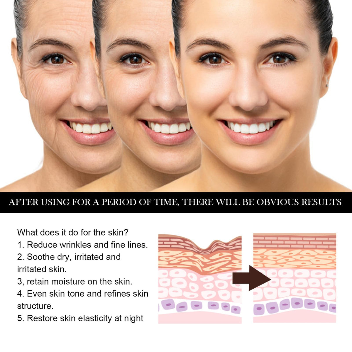 Nexolla Face Oil, Oil for the Face, Rosehip Oil Face Serum, Moisturising and Nourishing Face Oil, Everyday Oil, Body Oil for Skin Hydrate Serum