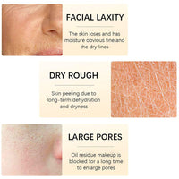Retinol Face Cream with Hyaluronic Acid & Vitamin E - Collagen Cream - Anti Wrinkle Face Cream - Skin Lightening Cream - Dark Spot Remover - Anti Aging Face Cream - Night Cream for Women