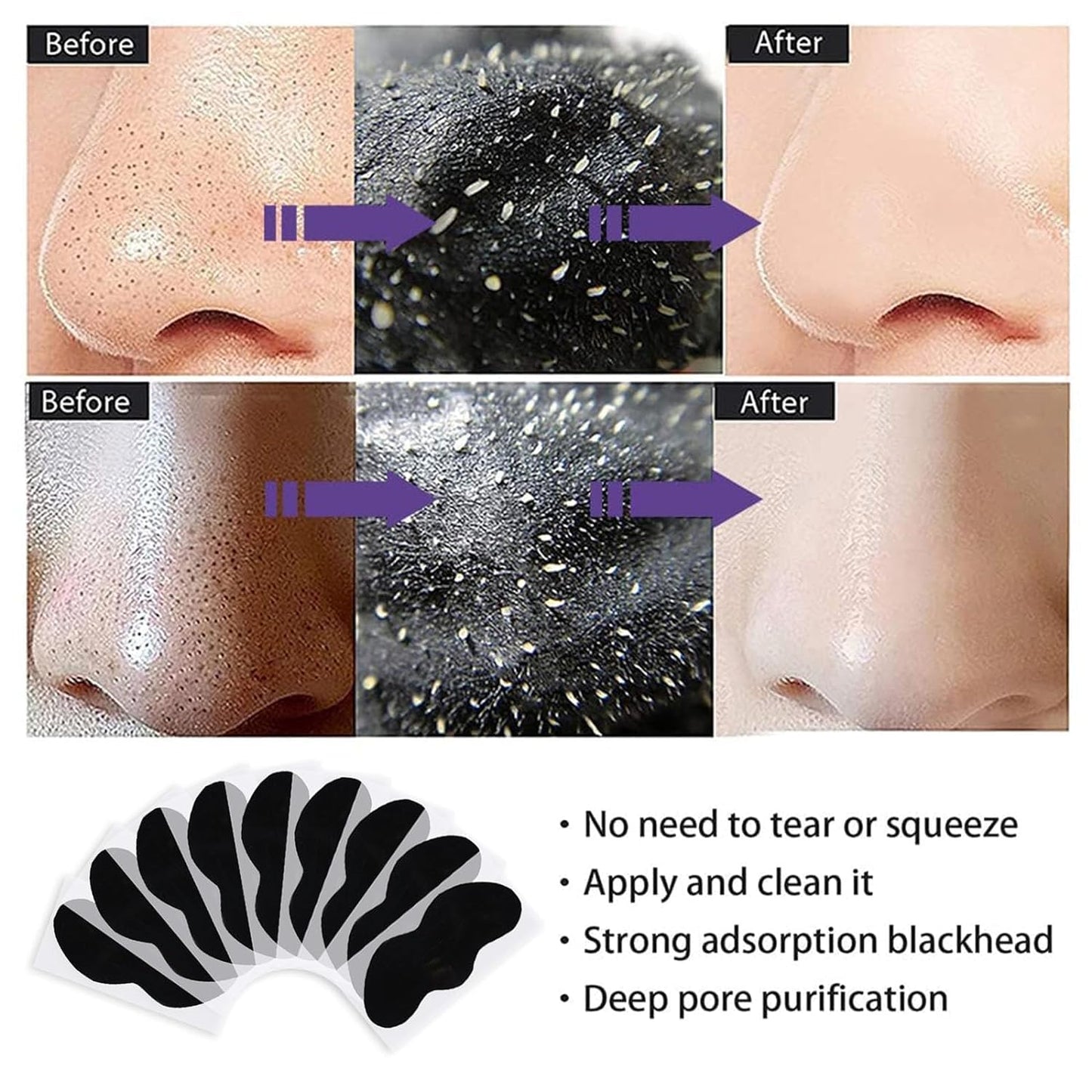 QEEROYO Nose Strips, Nose Strips Blackhead, 50 pcs Pore Strips, Blackhead Pore Strips, Pore Strips for Blackheads, Deep Cleansing Nose Strips, Deep Cleansing Nose Pore Strips for Madam Blackheads Removal