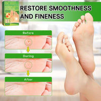 Soneat Wart Remover, 30pcs Verruca Treatment, Plantar Wart Remover for Hands, Feet, Effective Deep Verruca Removal Pads Patches, Pain Relief, Non-irritating Wart Treatment for Adults