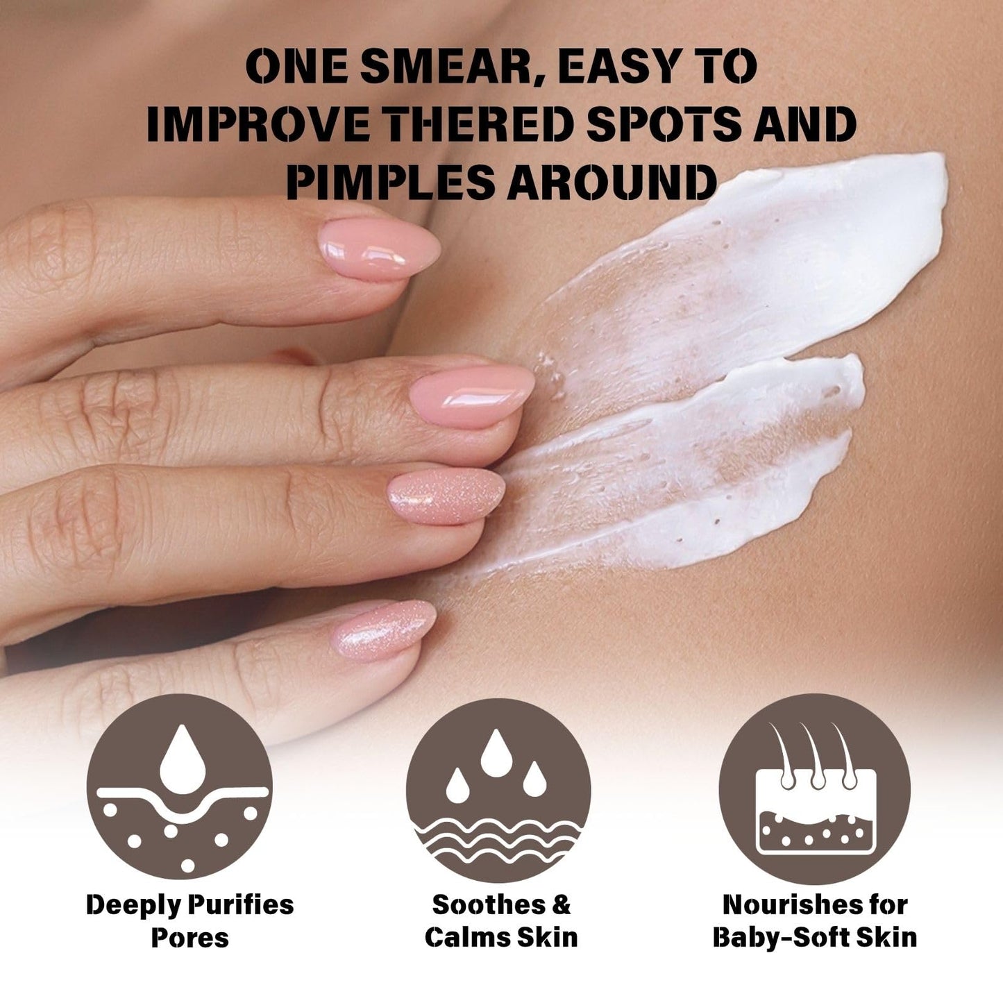 Strawberry Legs Treatment Cream – Body Cream for Strawberry Skin, Dry Skin Moisturiser with Exfoliating & Smoothing Formula, Foot Product for Very Dry Feet, Body Skin Care Lotion for Women & Men