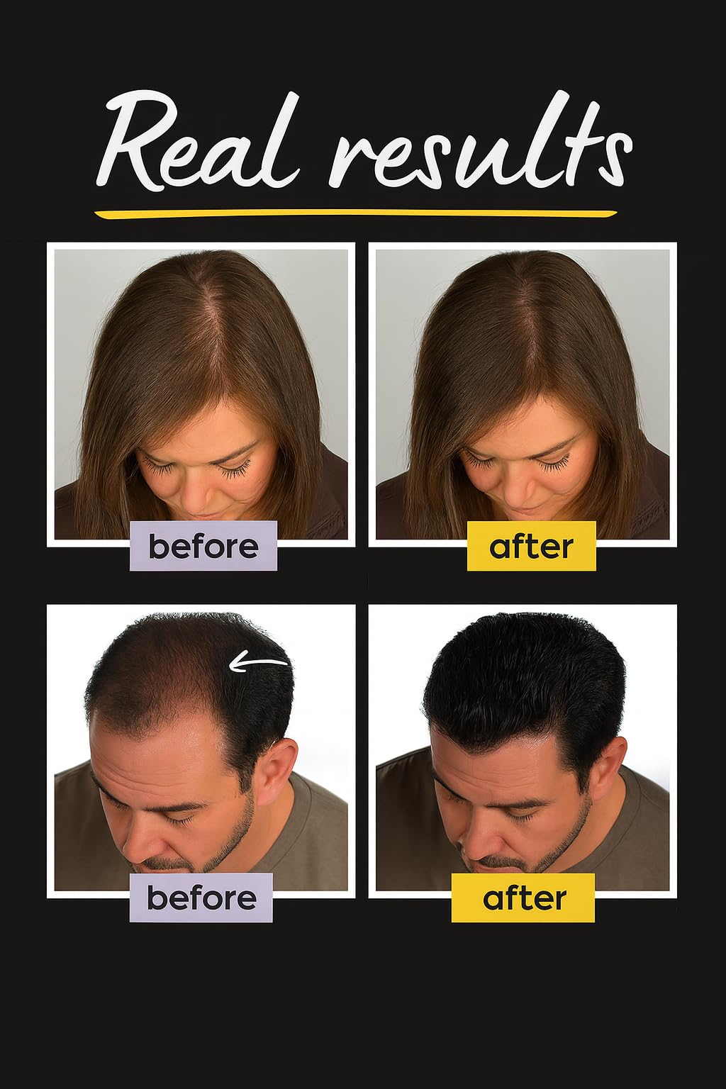 THICKIFY Hair Fibres for Thinning Undetectable & Natural - 28g Bottle - Completely Conceals Loss Instantly - Thickener Topper Fine Women Men (Light Blonde), Number Of Items: 1