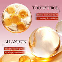 Muiefe 2Pcs Freckle Removal Cream, Dark Spot Remover for Face and Body, Dark Spot Corrector Cream with Vitamin C, E & Niacinamide, Fade Spots Blemishes, Reduces Hyperpigmentation, Improves Skin Tone