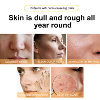 SingHao Collagen Multi Balm Stick,Multi Balm Stick Moisturizing Balm,Moisture Glow Multi Bal/m Sti/ck,Hydrating Collagen Moisturizer Face Ba/lm Stic/k,Anti Wrinkles Face Moisturiser B/alm
