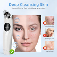 GUPAY Blackhead Remover Vacuum, Pore Vacuum with 1080p HD Camera Visible Facial Pore Cleanser with 4 Suction Heads, 5 Suction Power for Pimple Acne Whitehead Deep Cleansing Remover Tool