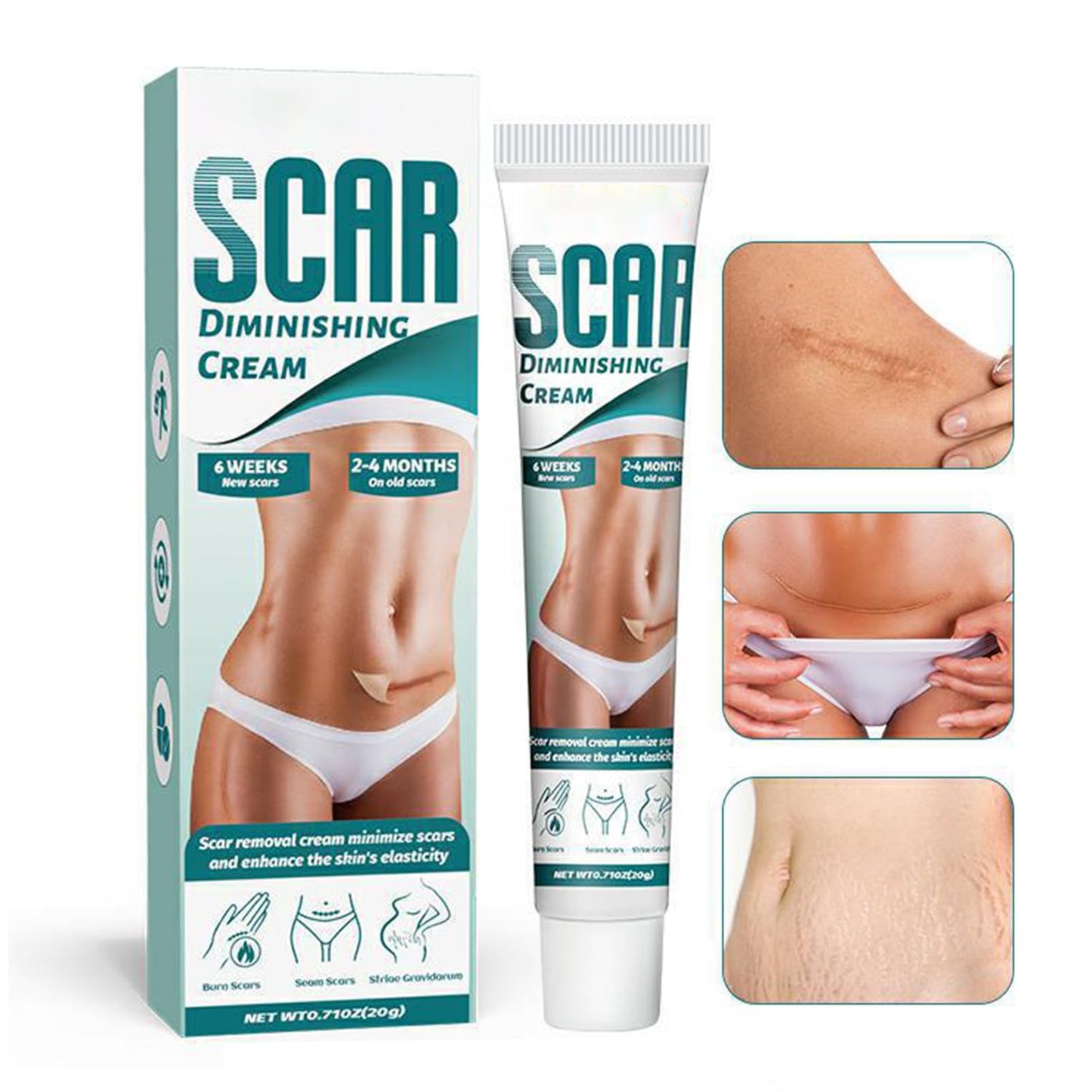 Scar Cream, Scar Removal Cream, Stretch Mark Removal Cream, Scar Erase, Skin Repair Cream for Face & Body Scar, for C-Section, Burns, Stretch Marks, Acne, Surgery, Effective for Both Old and New Scars