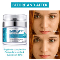 Shefave Dark Spot Remover For Face & Body, Pigmentation Removal Cream, Hyperpigmentation Treatment Melasma Cream - Reduces Dark Spots, Hyperpigmentation & Scars, Hydrates & Evens Skin Tone For Radiant Glow